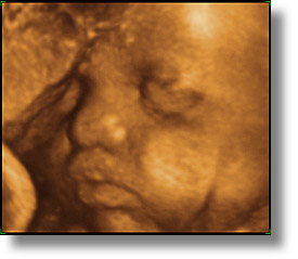 images/personal/Jack/Ultrasound/ultrasound-1.jpg
