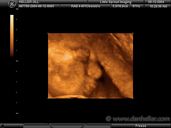 ultrasound-2.jpg