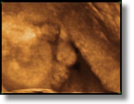 images/personal/Jack/Ultrasound/ultrasound-2.jpg