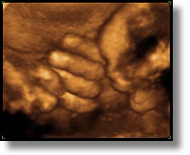 images/personal/Jack/Ultrasound/ultrasound-3.jpg