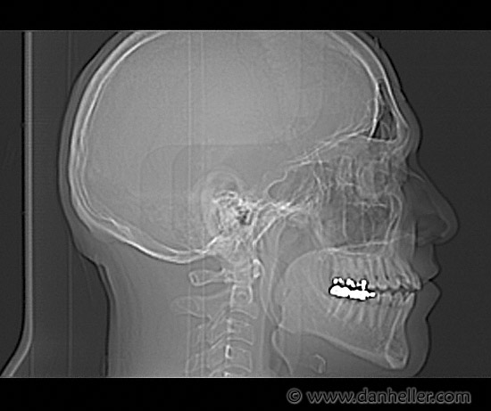 dan-xray-profile.jpg